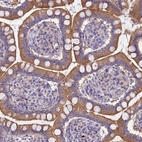 Immunohistochemical staining of human small intestine shows moderate cytoplasmic positivity in glandular cells.