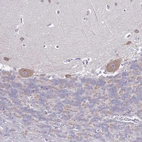 Immunohistochemical staining of human cerebellum shows weak cytoplasmic positivity in Purkinje cells.