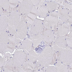 Immunohistochemical staining of human skeletal muscle shows no positivity in myocytes as expected.