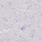 Immunohistochemical staining of human skeletal muscle shows no positivity in myocytes as expected.