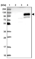 Lane 1: Marker [kDa] 250, 130, 95, 72, 55, 36, 28, 17, 10_br/_Lane 2: Human cell line RT-4_br/_Lane 3: Human cell line U-251MG sp_br/_Lane 4: Human plasma (IgG/HSA depleted)
