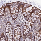 Anti-ADAMTS15 Antibody