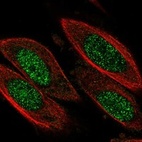 Anti-CCND3 Antibody