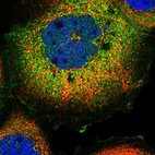 Immunofluorescent staining of human cell line A-431 shows localization to plasma membrane & cytosol.