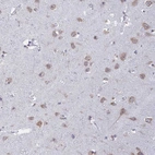 Anti-RPS19BP1 Antibody