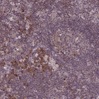 Immunohistochemical staining of human lymph node shows moderate nuclear positivity.