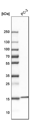 Western blot analysis in human cell line PC-3.