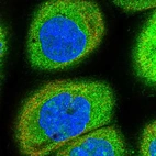 Immunofluorescent staining of human cell line A-431 shows localization to nucleus, nucleoli & cytosol.