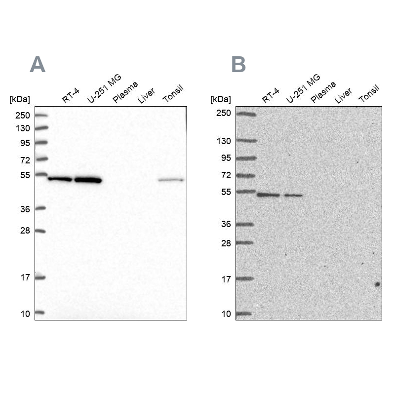 Anti-RUVBL2 Antibody