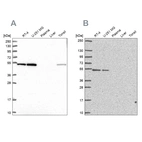 Anti-RUVBL2 Antibody