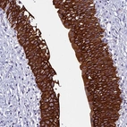 Anti-RBM41 Antibody