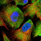 Immunofluorescent staining of human cell line U-251 MG shows localization to cytosol.