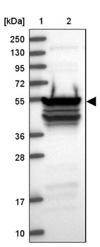 Lane 1: Marker [kDa] 250, 130, 95, 72, 55, 36, 28, 17, 10_br/_Lane 2: Human cell line RT-4