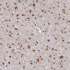 Anti-ABCA2 Antibody