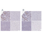 Anti-CHMP5 Antibody