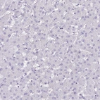 Immunohistochemical staining of human liver shows no cytoplasmic positivity in hepatocytes.