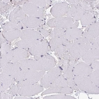 Immunohistochemical staining of human skeletal muscle shows no cytoplasmic positivity in myocytes as expected.