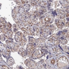 Anti-ARAP3 Antibody