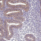 Anti-BSPRY Antibody