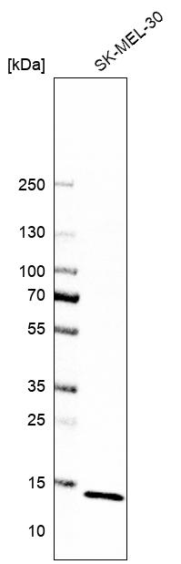 Anti-ATP6V1G1 Antibody