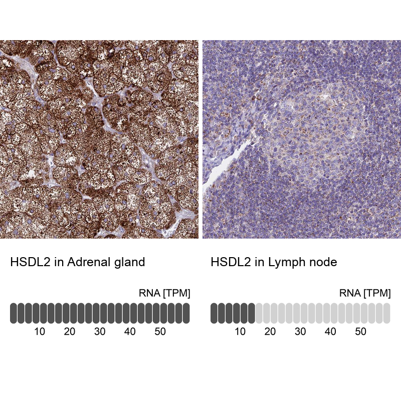 Anti-HSDL2 Antibody