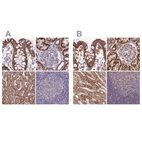 Immunohistochemical staining of human colon, kidney, liver and lymph node using Anti-HSDL2 antibody HPA042890 (A) shows similar protein distribution across tissues to independent antibody HPA050453 (B).