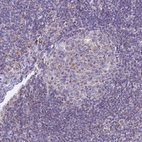 Immunohistochemical staining of human lymph node shows low expression as expected.
