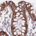 Immunohistochemical staining of human colon using Anti-HSDL2 antibody HPA042890.