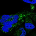 Immunofluorescent staining of human cell line RH-30 shows localization to mitochondria.