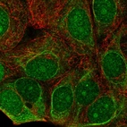 Immunofluorescent staining of human cell line MCF7 shows localization to nucleus, nucleoli, cytosol & intermediate filaments.