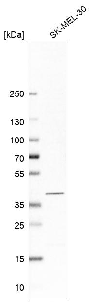 Anti-PSAT1 Antibody