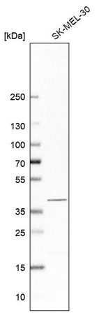 Anti-PSAT1 Antibody