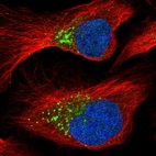 Immunofluorescent staining of human cell line U-2 OS shows localization to the Golgi apparatus & vesicles.