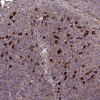 Anti-MIOS Antibody