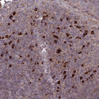 Anti-MIOS Antibody