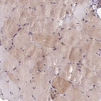 Immunohistochemical staining of human skeletal muscle shows moderate cytoplasmic positivity in myocytes.