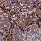Immunohistochemical staining of human duodenum shows strong cytoplasmic positivity in lymphoid and glandular cells.