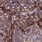 Immunohistochemical staining of human duodenum shows strong cytoplasmic positivity in lymphoid and glandular cells.
