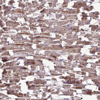 Immunohistochemical staining of human heart muscle shows moderate cytoplasmic positivity in cardiomyocytes.