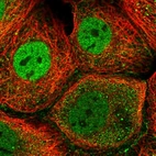 Immunofluorescent staining of human cell line A-431 shows localization to nucleoplasm, cytosol & cell junctions.