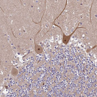 Immunohistochemical staining of human Cerebellum shows moderate cytoplasmic positivity in Purkinje cells.