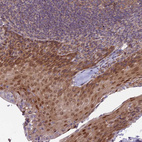 Immunohistochemical staining of human Tonsil shows moderate nuclear and cytoplasmic positivity in squamous epithelial cells.
