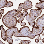 Immunohistochemical staining of human Placenta shows strong nuclear and cytoplasmic positivity in trophoblastic cells.