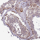 Anti-DTX2 Antibody