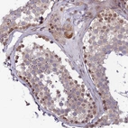 Immunohistochemical staining of human Testis shows moderate nuclear and cytoplasmic positivity in cells in seminiferous ducts.