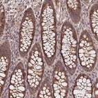 Immunohistochemical staining of human Colon shows moderate nuclear and cytoplasmic positivity in glandular cells.
