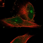 Immunofluorescent staining of human cell line U-251 MG shows localization to nucleoli.