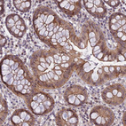 Anti-DTX2 Antibody