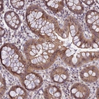 Immunohistochemical staining of human Colon shows moderate nuclear and cytoplasmic positivity in glandular cells.