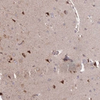 Immunohistochemical staining of human Cerebral cortex shows moderate nuclear and cytoplasmic positivity in neuronal cells.